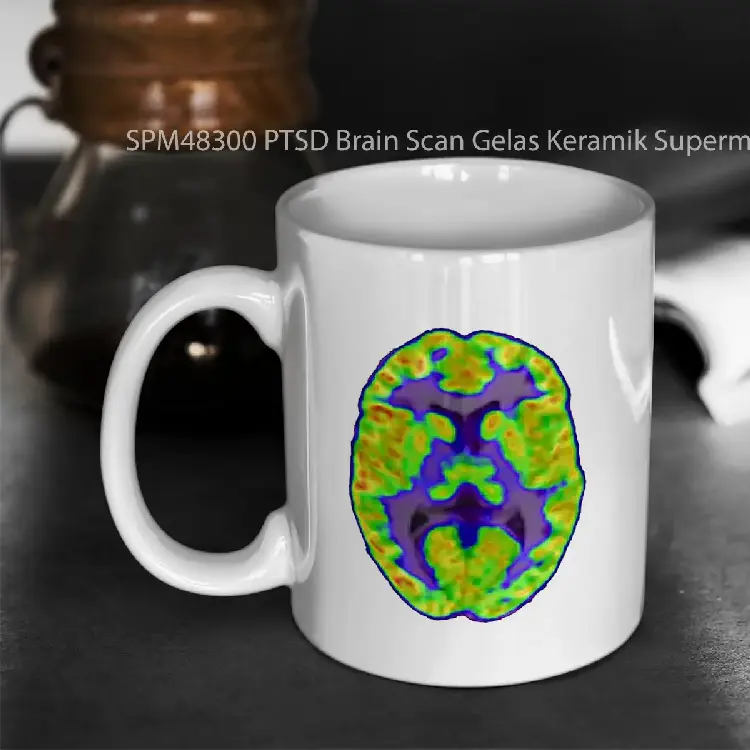SPM48300 PTSD Brain Scan Gelas Keramik Supermug